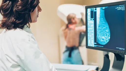 Doctor and patient making a mammography